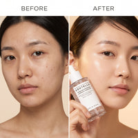 SKIN1004 Madagascar Centella Tone Brightening Capsule Ampoule — 100 mL / 3.38 FL OZ
